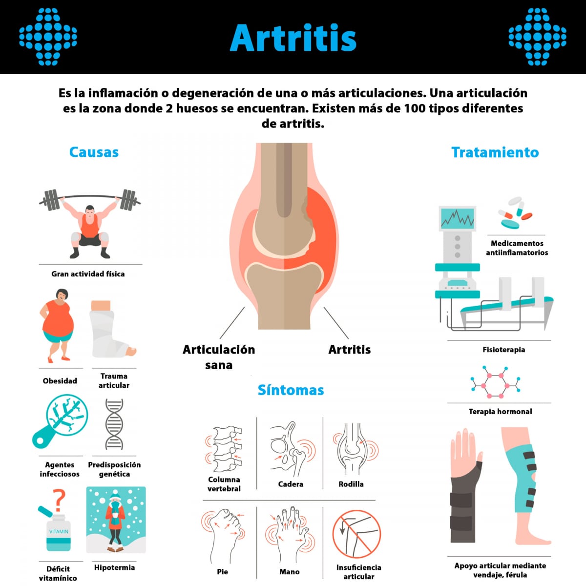 Artritis infografía